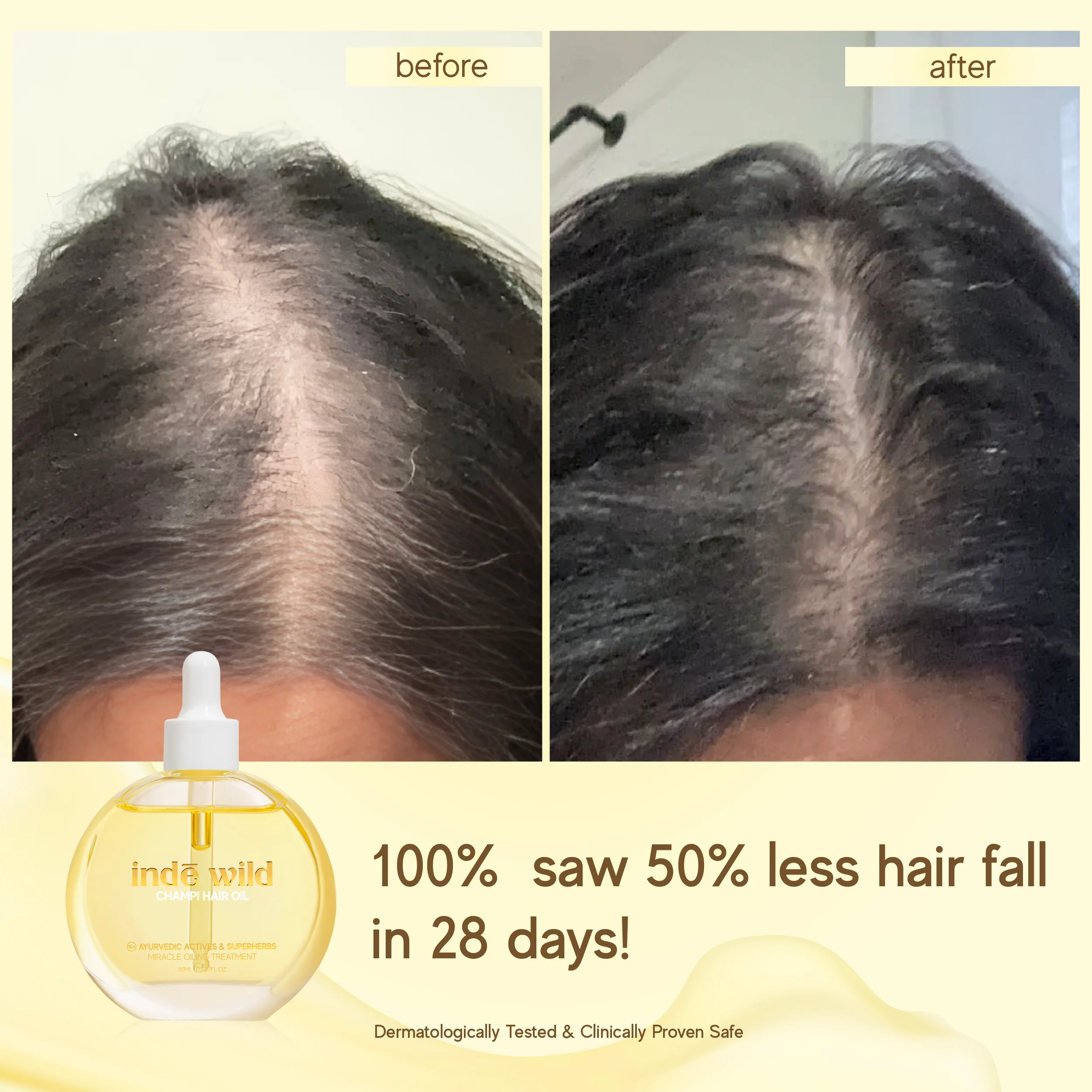 Champi Hair Oil - Image 11