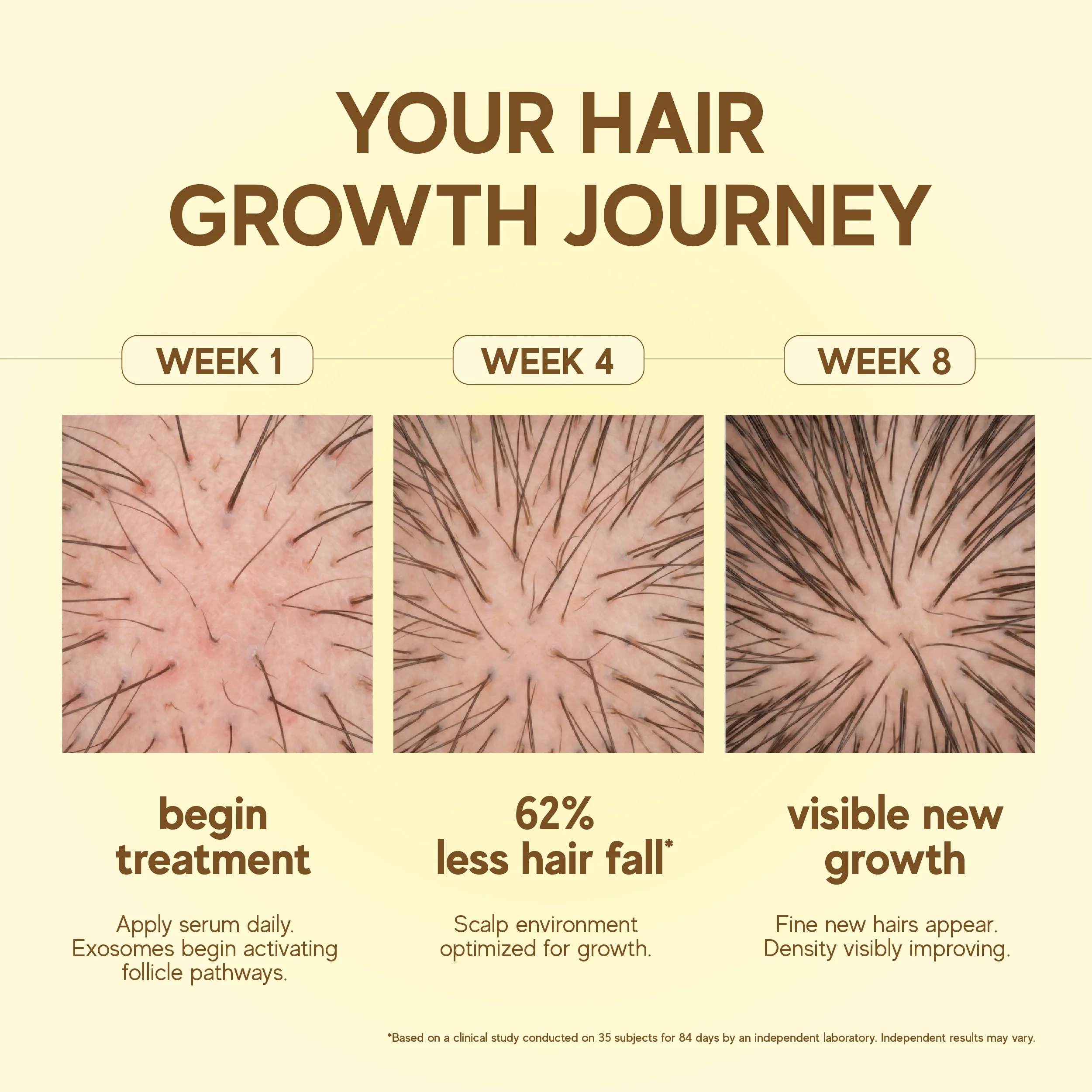 Moonlight Growth™ Scalp Serum - Image 10